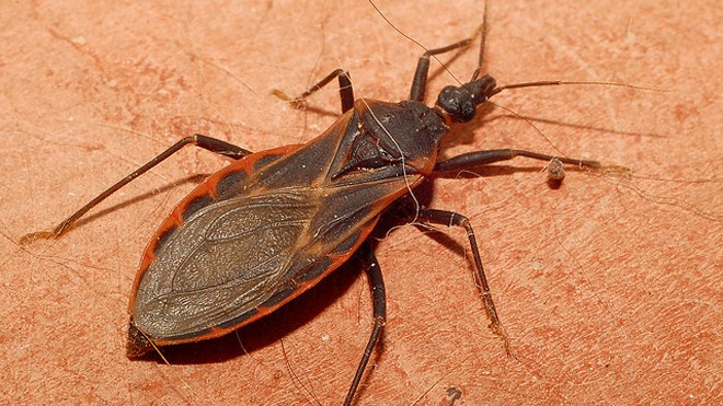 Bệnh Chagas